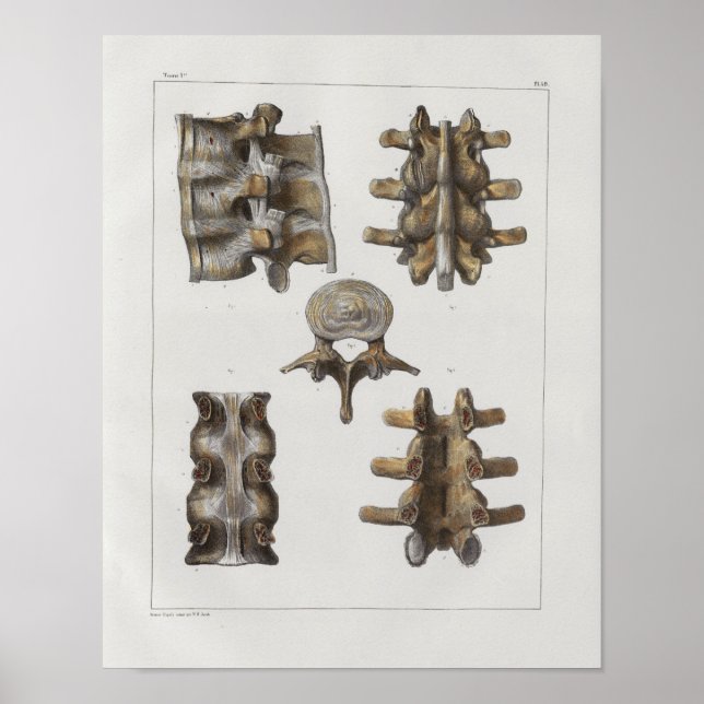 1867 Lumbar Spine Vintage Anatomy Print (Front)