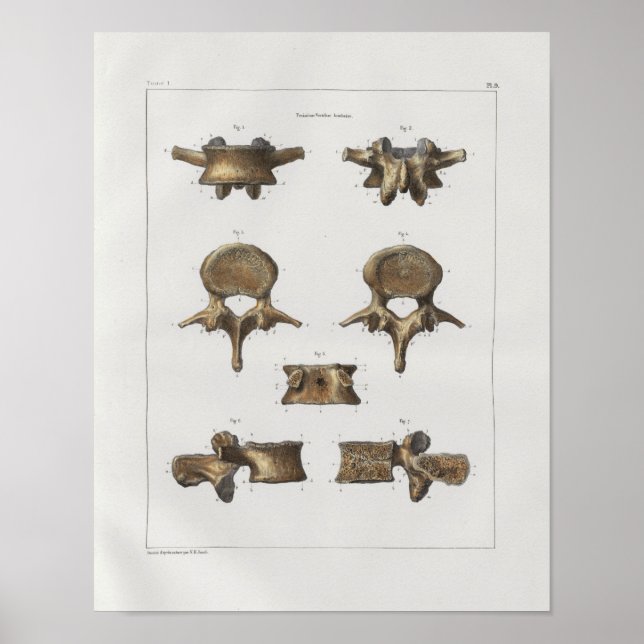1867 Spinal Vertebrae Bones Vintage Anatomy Print (Front)