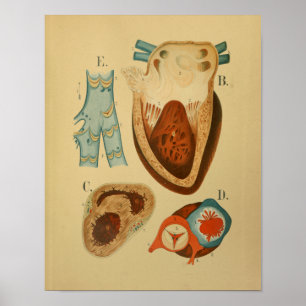 1879 Vintage Anatomy Print Human Heart Internal