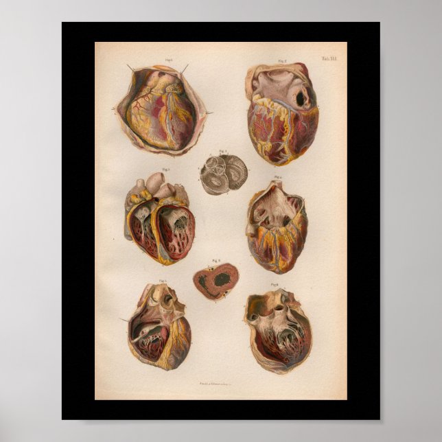 1879 Vintage Bock Anatomy Print Heart Muscles (Front)