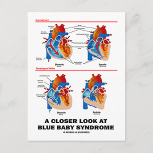 A Closer Look At Blue Baby Syndrome (Heart) Postcard