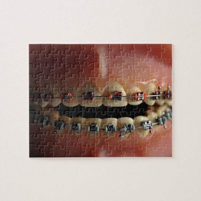 A dental model and Teeth braces Jigsaw Puzzle (Horizontal)