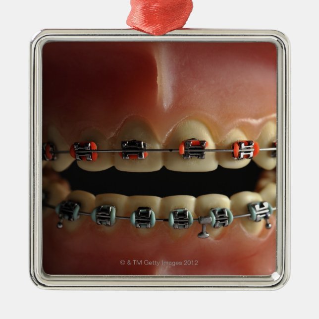 A dental model and Teeth braces Metal Tree Decoration (Front)