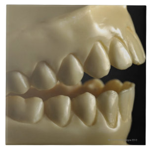 A dental model tile