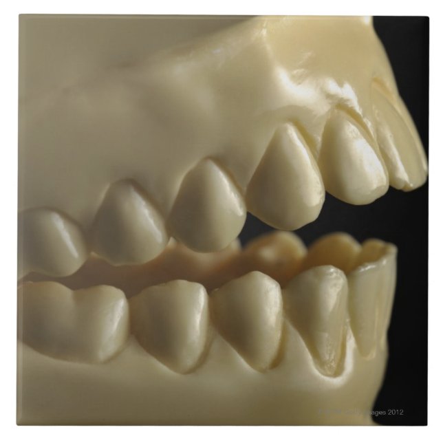 A dental model tile (Front)