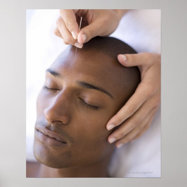 Acupuncture. Acupuncturist inserting a needle Poster (Front)