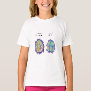 ADHD:It is better to be high-spirited T-Shirt