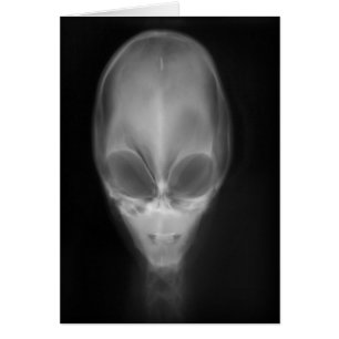 Alien Skull X-ray
