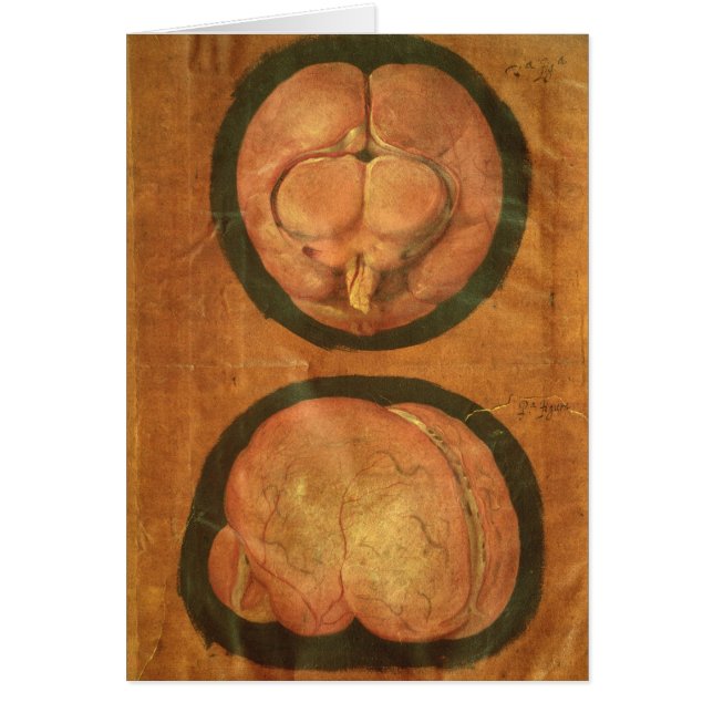 Anatomical drawing of the human brain (Front)