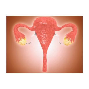 Anatomy Of Female Uterus With Ovaries Canvas Print
