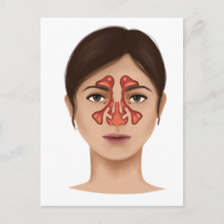 Anatomy Of Nasal Sinuses Postcard
