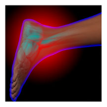 Ankle Pain