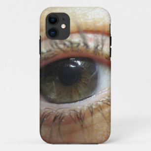 Another Eye Case-Mate iPhone Case