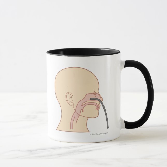 Anterior Rhinoscopy Mug (Right)