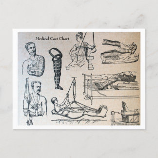 Antique Medical Casts Chart Postcard