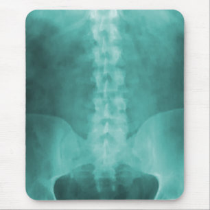 Aqua Digital X-Ray Art Mousepad