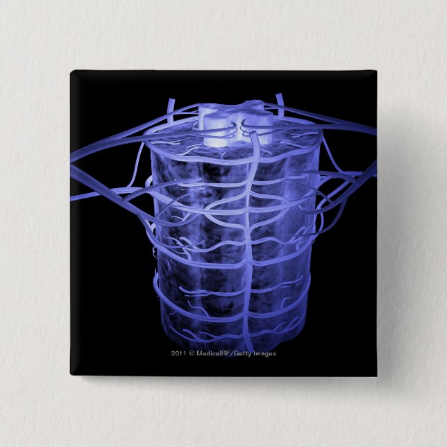 Arteries surrounding part of the spinal column 15 cm square badge (Front)