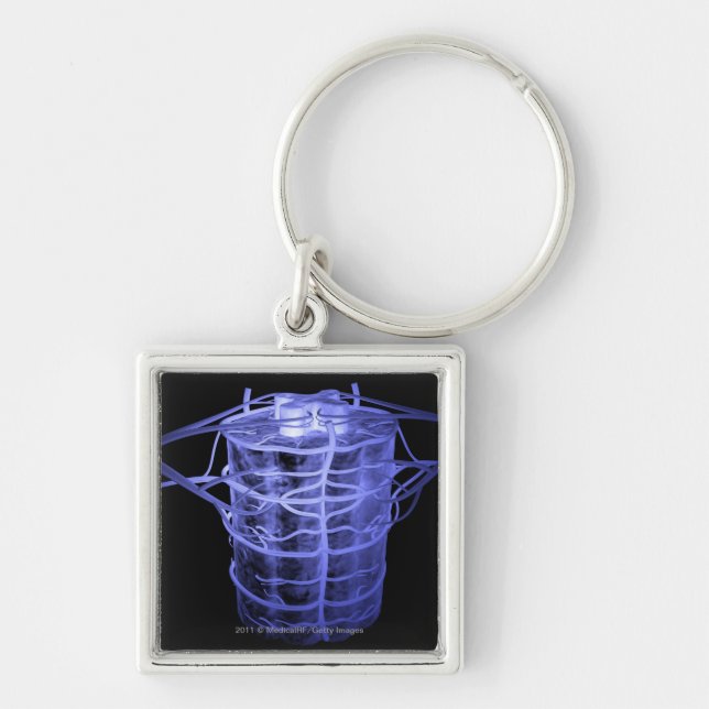 Arteries surrounding part of the spinal column key ring (Front)