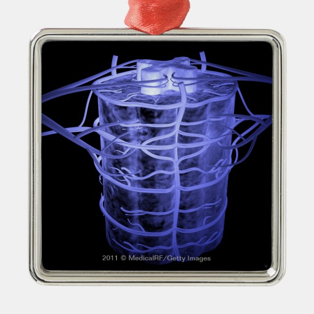 Arteries surrounding part of the spinal column metal tree decoration (Front)