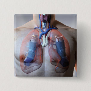 Asthma 15 Cm Square Badge