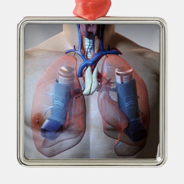 Asthma Metal Tree Decoration (Front)