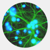 Astrocyte Are Star Shaped Glial Cells in the Brain