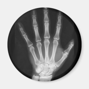 B&W X-ray Skeleton Hand Magnet