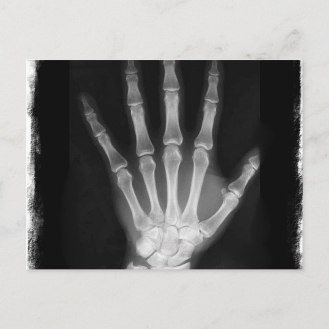 B&W X-ray Skeleton Hand Postcard (Front)