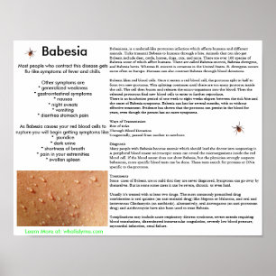 Babesia Symptoms and Transmission Poster