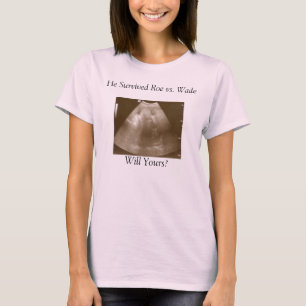 Baby2, He Survived Roe vs. Wade, Will Yours? T-Shirt