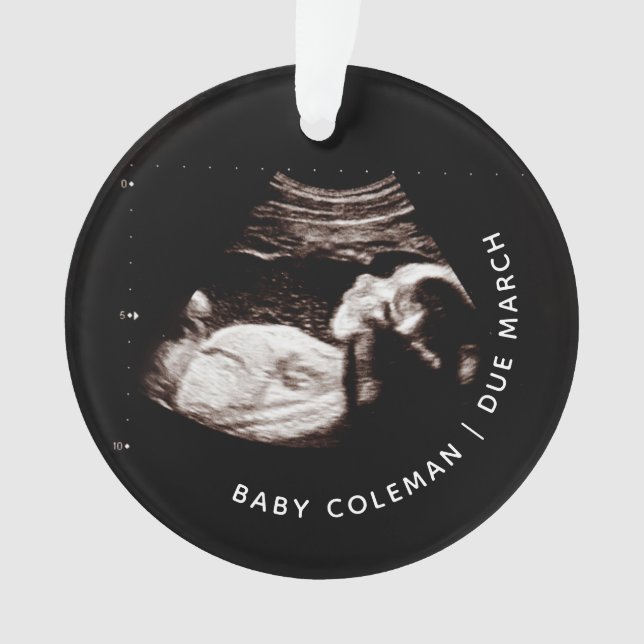 Baby Christmas Ornament Pregnancy Ultrasound Photo (Front)