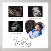 Baby Scan Photo sonogram newborn baby keepsake
