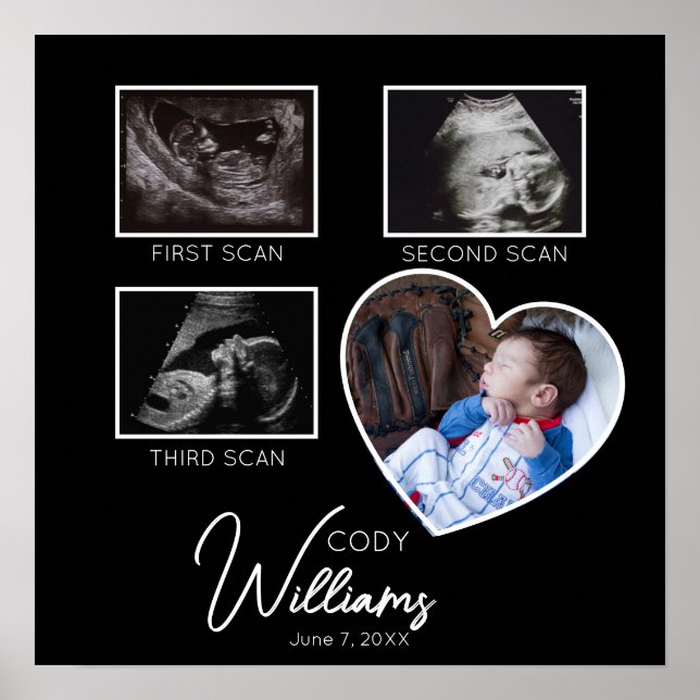  Baby Scan Photo sonogram newborn baby keepsake Poster (Front)