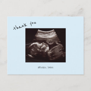  Baby Shower Ultrasound Cute Icy Blue Thank You Postcard