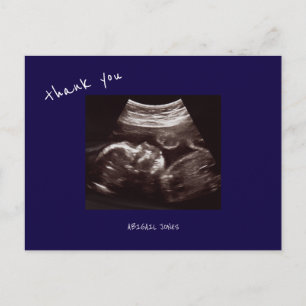 Baby Shower Ultrasound Cute Navy Thank You Postcard