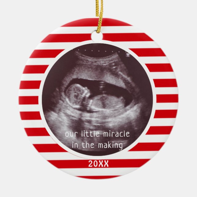 Baby Ultrasound Photo Red White Stripe Christmas Ceramic Tree Decoration (Front)