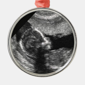 Baby's 1st Christmas Metal Tree Decoration