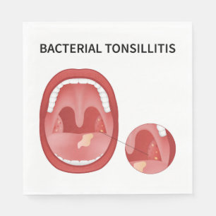 Bacterial tonsillitis napkin