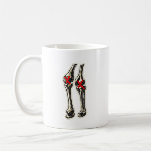 Bad Knees – Funny Skeleton Knee Illustration Coffee Mug