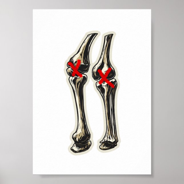 Bad Knees – Funny Skeleton Knee Illustration Poster (Front)