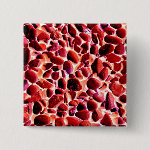 BEACH PEBBLES 15 CM SQUARE BADGE