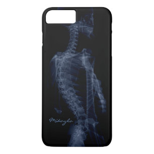 Beautiful, Personalised Body X-Ray Case-Mate iPhone Case