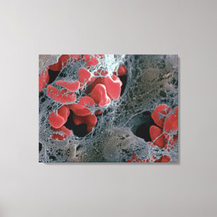 Blood Clot 2 Canvas Print