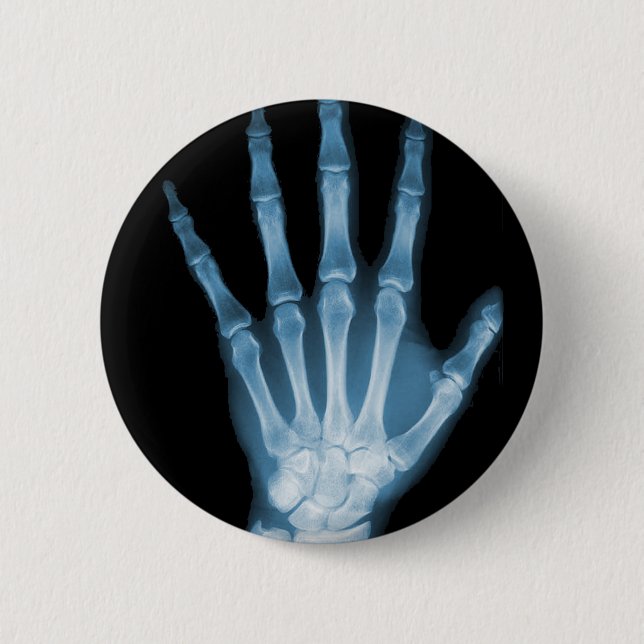 Blue X-ray Skeleton Hand 6 Cm Round Badge (Front)