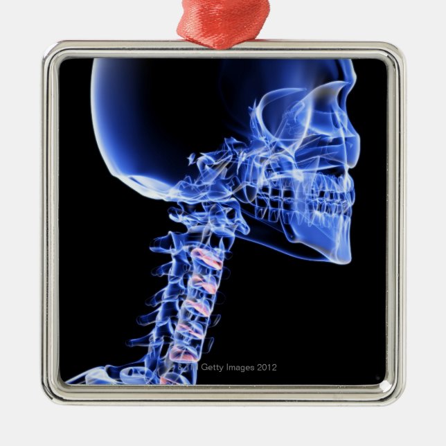 Bones of the Head and Neck Metal Tree Decoration (Front)