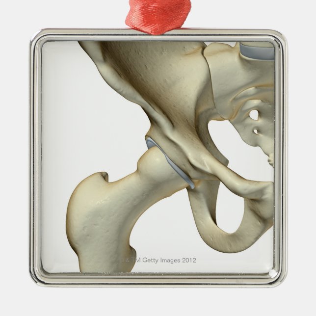 Bones of the Hip 5 Metal Tree Decoration (Front)