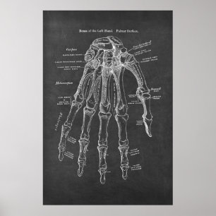Bones of the Left-Hand Palmar Surface Anatomy Poster