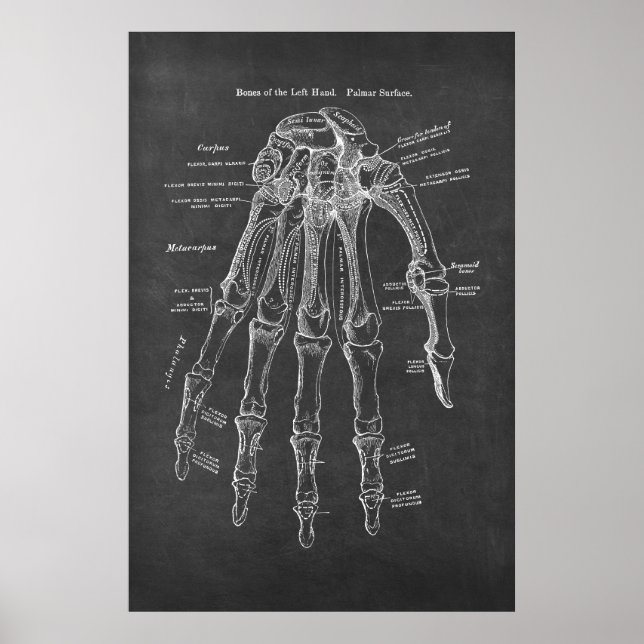Bones of the Left-Hand Palmar Surface Anatomy Poster (Front)