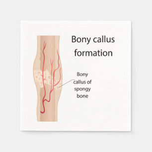 Bony callus formation  napkin