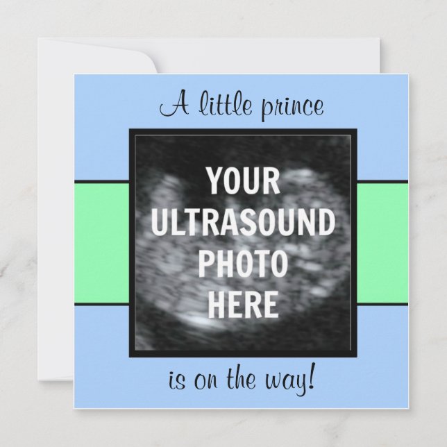 Boy Baby Customised Ultrasound Photo Template (Front)